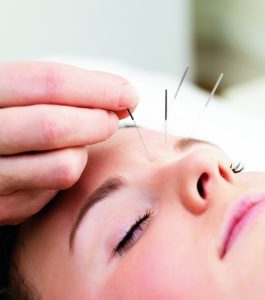 Community Acupuncture - Winter Immune Boost @ Salt of the Earth, Center for Healing